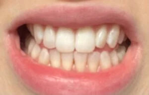 image comparison before